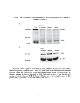 6
Figure 1: Gli1 is Higher in Ventral Progenitors, and Gli3 Repressor is Increased in
Dorsal Progenitors
Figure 1: Gli1 is Higher in Ventral Progenitors, and Gli3 Repressor is Increased in
Dorsal Progenitors. Lysates from 3 adult WT mice were micro-dissected and collected
from the Dorsal and Ventral SVZ. These samples were then blotted for Gli1 and Gli3. A.
Western blotting shows an increase of Gli3 Repressor protein in the Dorsal SVZ
compared with the Ventral SVZ. B. Western blotting shows a marked increase of Gli1
protein in the Ventral SVZ compared with the Dorsal SVZ.
 
