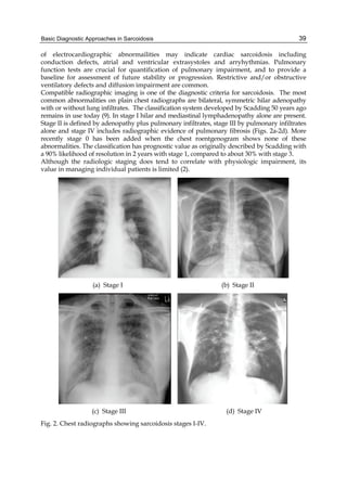 Scadding Radiological Classification Sarcoidosis Diagnosis And Management M Motamedi | PDF