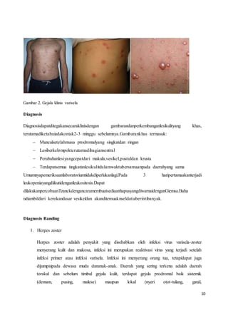 10
Gambar 2. Gejala klinis varisela
Diagnosis
Diagnosisdapatditegakansecaraklinisdengan gambarandanperkembanganlesikulityang khas,
terutamadiketahuiadakontak2-3 minggu sebelumnya.Gambarankhas termasuk:
 Munculsetelahmasa prodromalyang singkatdan ringan
 Lesiberkelompokterutamadibagiansentral
 Perubahanlesiyangcepatdari makula,vesikel,pustuldan krusta
 Terdapatsemua tingkatanlesikulitdalamwaktubersamaanpada daerahyang sama
Umumnyapemeriksaanlaboratoriumtidakdiperlukanlagi.Pada 3 haripertamaakanterjadi
leukopeniayangdiikutidenganleukositosis.Dapat
dilakukanpercobaanTzanckdengancaramembuatsediaanhapusyangdiwarnaidenganGiemsa.Baha
ndiambildari kerokandasar vesikeldan akanditemuaknseldatiaberintibanyak.
Diagnosis Banding
1. Herpes zoster
Herpes zoster adalah penyakit yang disebabkan oleh infeksi virus varisela-zoster
menyerang kulit dan mukosa, infeksi ini merupakan reaktivasi virus yang terjadi setelah
infeksi primer atau infeksi varisela. Infeksi ini menyerang orang tua, tetapidapat juga
dijumpaipada dewasa muda dananak-anak. Daerah yang sering terkena adalah daerah
torakal dan sebelum timbul gejala kulit, terdapat gejala prodromal baik sistemik
(demam, pusing, malese) maupun lokal (nyeri otot-tulang, gatal,
 