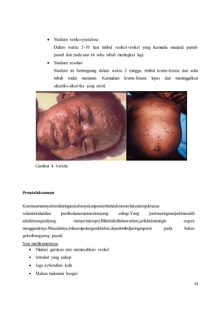 12
 Stadium vesiko-pustulosa
Dalam waktu 5-10 hari timbul vesikel-vesikel yang kemudia menjadi pustul-
pustul dan pada saat ini suhu tubuh meningkat lagi.
 Stadium resolusi
Stadium ini berlangsung dalam waktu 2 minggu, timbul krusta-krusta dan suhu
tubuh mulai menurun. Kemudian krusta-krusta lepas dan meninggalkan
sikatriks-sikatriks yang atrofi.
Gambar 4. Variola
Penatalaksanaan
Karenaumumnyabersifatringan,kebanyakanpenderitatidakmemerlukanterapikhusus
selainistirahatdan pemberianasupancairanyang cukup.Yang justruseringmenjadimasalah
adalahrasagatalyang menyertaierupsi.Bilatidakditahan-tahan,jarikitatentuingin segera
menggaruknya.Masalahnya,bilasampaitergarukhebat,dapattimbuljaringanparut pada bekas
gelembungyang pecah.
Non medikamentosa
 Hindari garukan dan memecahkan vesikel
 Istirahat yang cukup
 Jaga kebersihan kulit
 Makan makanan bergizi
 