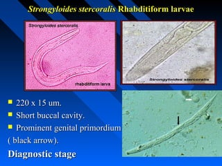 Strongyloides stercoralis Rhabditiform larvae




  220 x 15 um.
 Short buccal cavity.
 Prominent genital primordium

( black arrow).
Diagnostic stage
 