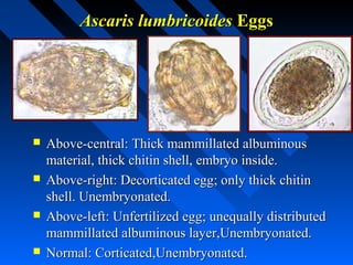 Ascaris lumbricoides Eggs




   Above-central: Thick mammillated albuminous
    material, thick chitin shell, embryo inside.
   Above-right: Decorticated egg; only thick chitin
    shell. Unembryonated.
   Above-left: Unfertilized egg; unequally distributed
    mammillated albuminous layer,Unembryonated.
   Normal: Corticated,Unembryonated.
 