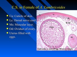 C.S. in Female of A. Lumbricoides

   Cu: Cuticle of skin.
   Lc: Dorsal nerve cord.
   Ms: Muscular layer.
   Od: Oviduct of ovary.
   Uterus filled with
    eggs.
 