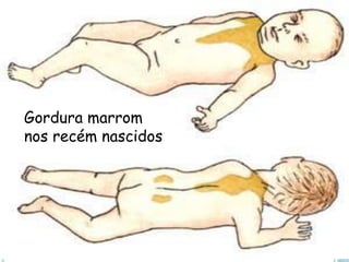 Gordura marrom
nos recém nascidos
 