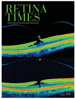 RETINA
TIMESThe Ofﬁcial Publication of the American Society of Retina Specialists
 
