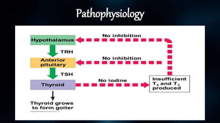 Pathophysiology
 