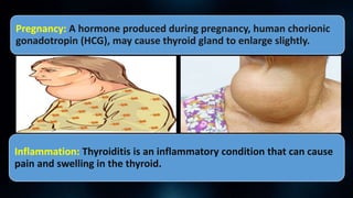 Pregnancy: A hormone produced during pregnancy, human chorionic
gonadotropin (HCG), may cause thyroid gland to enlarge slightly.
Inflammation: Thyroiditis is an inflammatory condition that can cause
pain and swelling in the thyroid.
 