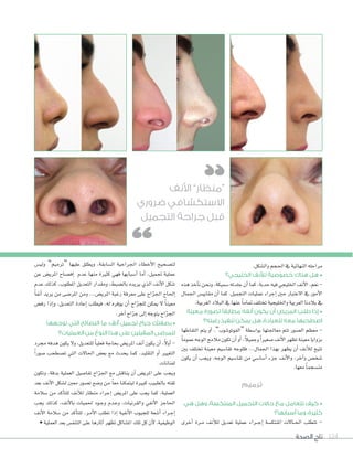 ‫الصحة‬ ‫تاج‬ 124
.‫وال�صكل‬ ‫احلجم‬ ‫يف‬ ‫النهائية‬ ‫مراحله‬
‫الخليجي؟‬ ‫لألنف‬ ‫خصوصية‬ ‫هناك‬ ‫هل‬ •
‫هذه‬‫أخذ‬‫ا‬‫ن‬‫ونحن‬،‫�صميكة‬‫جلدته‬‫أن‬‫ا‬‫كما‬،‫حدبة‬‫فيه‬‫اخلليجي‬‫أنف‬‫ل‬‫ا‬،‫نعم‬-
‫اجلمال‬ ‫مقايي�س‬ ‫أن‬‫ا‬ ‫كما‬ .‫التجميل‬ ‫عمليات‬ ‫إجراء‬‫ا‬ ‫حني‬ ‫العتبار‬ ‫يف‬ ‫أمور‬‫ل‬‫ا‬
.‫الغربية‬ ‫البالد‬ ‫يف‬ ‫عنها‬ ً‫ا‬‫متام‬ ‫تختلف‬ ‫واخلليجية‬ ‫العربية‬ ‫بالدنا‬ ‫يف‬
‫معينة‬ ‫لصورة‬ ‫مطابقًا‬ ‫أنفه‬ ‫يكون‬ ‫أن‬ ‫المريض‬ ‫طلب‬ ‫إذا‬ •
‫رغبته؟‬ ‫تنفيذ‬ ‫يمكن‬ ‫هل‬ ،‫للعيادة‬ ‫معه‬ ‫اصطحبها‬
‫التقاطها‬ ‫يتم‬ ‫أو‬‫ا‬ ،”‫“الفوتو�صوب‬ ‫بوا�سطة‬ ‫معاجلتها‬ ‫تتم‬ ‫ال�سور‬ ‫معظم‬ -
ً‫ا‬‫عموم‬‫الوجه‬‫مالمح‬‫تكون‬‫أن‬‫ا‬‫أو‬‫ا‬،ً‫ال‬‫وجمي‬ ً‫ا‬‫�سغري‬‫أنف‬‫ل‬‫ا‬‫تظهر‬‫معينة‬‫بزوايا‬
‫بني‬ ‫تختلف‬ ‫معينة‬ ‫تقا�سيم‬ ‫فللوجه‬ ...‫اجلمال‬ ‫بهذا‬ ‫يظهر‬ ‫أن‬‫ا‬ ‫أنف‬‫ال‬‫ل‬ ‫تتيح‬
‫يكون‬ ‫أن‬‫ا‬ ‫ويجب‬ ،‫الوجه‬ ‫تقا�سيم‬ ‫من‬ ‫أ�سا�سي‬‫ا‬ ‫جزء‬ ‫أنف‬‫ل‬‫وا‬ ،‫آخر‬‫ا‬‫و‬ ‫�سخ�ض‬
.‫معها‬ ً‫ا‬‫من�صجم‬
‫ترميم‬
‫هي‬ ‫وهل‬ ،‫المنتكسة‬ ‫التجميل‬ ‫حاالت‬ ‫مع‬ ‫تتعامل‬ ‫كيف‬ •
‫أسبابها؟‬ ‫وما‬ ،‫كثيرة‬
‫أخرى‬‫ا‬ ‫�رة‬�‫م‬ ‫أنف‬‫ال‬‫ل‬ ‫تعديل‬ ‫عملية‬ ‫�راء‬��‫ج‬‫إ‬‫ا‬ ‫املنتك�صة‬ ‫�الت‬�‫حل‬‫ا‬ ‫تتطلب‬ -
‫ولي�س‬ ”‫“ترميم‬ ‫عليها‬ ‫ويطلق‬ ،‫ال�صابقة‬ ‫اجلراحية‬ ‫أخطاء‬‫ل‬‫ا‬ ‫لت�صحيح‬
‫عن‬ ‫املري�س‬ ‫إف�صاح‬‫ا‬ ‫عدم‬ ‫منها‬ ‫كثرية‬ ‫فهي‬ ‫أ�صبابها‬‫ا‬ ‫أما‬‫ا‬ ،‫جتميل‬ ‫عملية‬
‫عدم‬ ‫كذلك‬ ،‫املطلوب‬ ‫التعديل‬ ‫ومقدار‬ ،‫بال�صبط‬ ‫يريده‬ ‫الذي‬ ‫أنف‬‫ل‬‫ا‬ ‫�صكل‬
ً‫ا‬‫أنف‬‫ا‬ ‫يريد‬ ‫من‬ ‫املر�سى‬ ‫ومن‬ ...‫املري�ض‬ ‫رغبة‬ ‫معرفة‬ ‫على‬ ‫اح‬ّ‫ر‬‫اجل‬ ‫إحلاح‬‫ا‬
‫رف�ض‬ ‫إذا‬‫ا‬‫و‬ ،‫التعديل‬ ‫إعادة‬‫ا‬ ‫فيطلب‬ ،‫له‬ ‫يوفره‬ ‫أن‬‫ا‬ ‫اح‬ّ‫ر‬‫للج‬ ‫ميكن‬ ‫ل‬ ً‫ا‬‫معين‬
.‫آخر‬‫ا‬ ‫اح‬ّ‫ر‬‫ج‬ ‫إلى‬‫ا‬ ‫يتوجه‬ ‫اح‬ّ‫ر‬‫اجل‬
‫توجهها‬ ‫التي‬ ‫النصائح‬ ‫ما‬ ،‫أنف‬ ‫تجميل‬ ‫جراح‬ ‫بصفتك‬ •
‫العمليات؟‬ ‫من‬ ‫النوع‬ ‫هذا‬ ‫على‬ ‫المقبلين‬ ‫للمرضى‬
‫جمرد‬ ‫هدفه‬ ‫يكون‬ ‫ول‬ ،‫للتعديل‬ ً‫ا‬‫فعلي‬ ‫بحاجة‬ ‫املري�س‬ ‫أنف‬‫ا‬ ‫يكون‬ ‫أن‬‫ا‬ ،ً‫ل‬‫أو‬‫ا‬ -
ً‫ا‬‫�صور‬ ‫ت�صطحب‬ ‫التي‬ ‫احلالت‬ ‫بع�س‬ ‫مع‬ ‫يحدث‬ ‫كما‬ ،‫التقليد‬ ‫أو‬‫ا‬ ‫التغيري‬
.‫لفنانات‬
‫وتكون‬ ،‫بدقة‬ ‫العملية‬ ‫تفا�سيل‬ ‫اح‬ّ‫ر‬‫اجل‬ ‫مع‬ ‫يناق�ض‬ ‫أن‬‫ا‬ ‫املري�ض‬ ‫على‬ ‫ويجب‬
‫بعد‬ ‫أنف‬‫ل‬‫ا‬ ‫ل�سكل‬ ‫معني‬ ‫ت�سور‬ ‫و�سع‬ ‫من‬ ً‫ا‬‫مع‬ ‫ليتمكنا‬ ‫كبرية‬ ‫بالطبيب‬ ‫ثقته‬
‫�سالمة‬ ‫من‬ ‫أكد‬‫ا‬‫للت‬ ‫أنف‬‫ال‬‫ل‬ ‫منظار‬ ‫إجراء‬‫ا‬ ‫املري�ض‬ ‫على‬ ‫يجب‬ ‫كما‬ ،‫العملية‬
‫يجب‬ ‫كذلك‬ ،‫أنف‬‫ل‬‫با‬ ‫حلميات‬ ‫�ود‬�‫ج‬‫و‬ ‫�دم‬�‫ع‬‫و‬ ،‫والقرنيات‬ ‫أنفي‬‫ل‬‫ا‬ ‫احلاجز‬
‫أنف‬‫ل‬‫ا‬ ‫�صالمة‬ ‫من‬ ‫أكد‬‫ا‬‫للت‬ ،‫�ر‬�‫م‬‫أ‬‫ل‬‫ا‬ ‫تطلب‬ ‫إذا‬‫ا‬ ‫أنفية‬‫ل‬‫ا‬ ‫للجيوب‬ ‫أ�صعة‬‫ا‬ ‫�راء‬�‫ج‬‫إ‬‫ا‬
• ‫العملية‬ ‫بعد‬ ‫التنف�ض‬ ‫على‬ ‫آثارها‬‫ا‬ ‫تظهر‬ ‫امل�ساكل‬ ‫تلك‬ ‫كل‬ ‫أن‬‫ل‬ ،‫الوظيفية‬
‫األنف‬ ”‫“منظار‬
‫ضروري‬ ‫االستكشافي‬
‫التجميل‬ ‫جراحة‬ ‫قبل‬
 