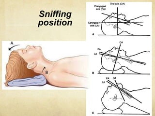 Sniffing
position
 
