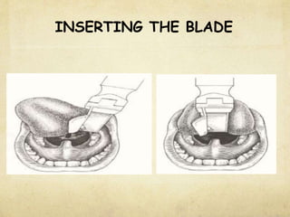 INSERTING THE BLADE
 