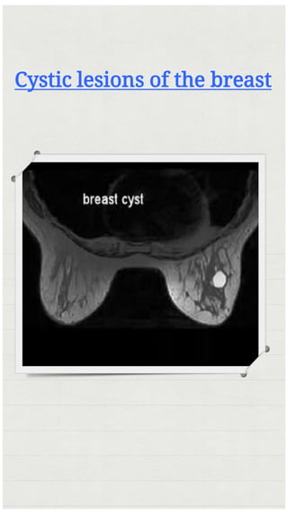 Cystic lesions of the breast