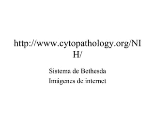 http://www.cytopathology.org/NIH/ Sistema de Bethesda Imágenes de internet 