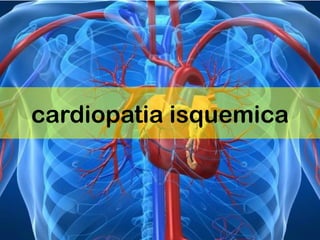 cardiopatia isquemica
 