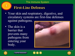 The Immune System
1
      First-Line Defenses
• Your skin and respiratory, digestive, and
  circulatory systems are first-line defenses
  against pathogens.
• The skin is a
  barrier that
  prevents many
  pathogens from
  entering your
  body.
 