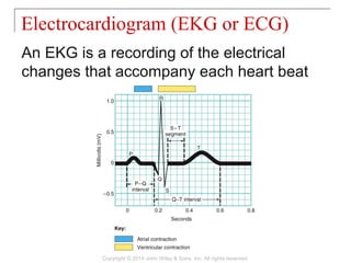 An EKG is a recording of the electrical
changes that accompany each heart beat
Electrocardiogram (EKG or ECG)
Copyright © 2014 John Wiley & Sons, Inc. All rights reserved.
 