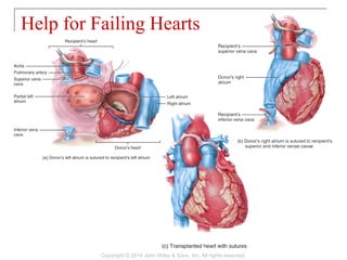 Help for Failing Hearts
Copyright © 2014 John Wiley & Sons, Inc. All rights reserved.
 