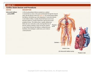 Copyright © 2014 John Wiley & Sons, Inc. All rights reserved.
 