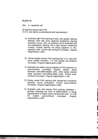 Apoptosis thesis 05 image