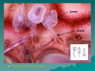 ◆ Pedicelario venenoso
 
