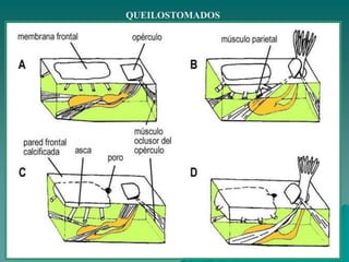 QUEILOSTOMADOS
 