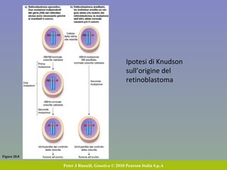 Figura 20.8 Peter J Russell,  Genetica  © 2010 Pearson Italia S.p.A Ipotesi di Knudson sull’origine del retinoblastoma 