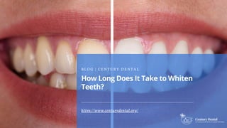 How Long Does It Take to Whiten
Teeth?
B L O G | C E N T U R Y D E N T A L
https://www.centurydental.org/
 