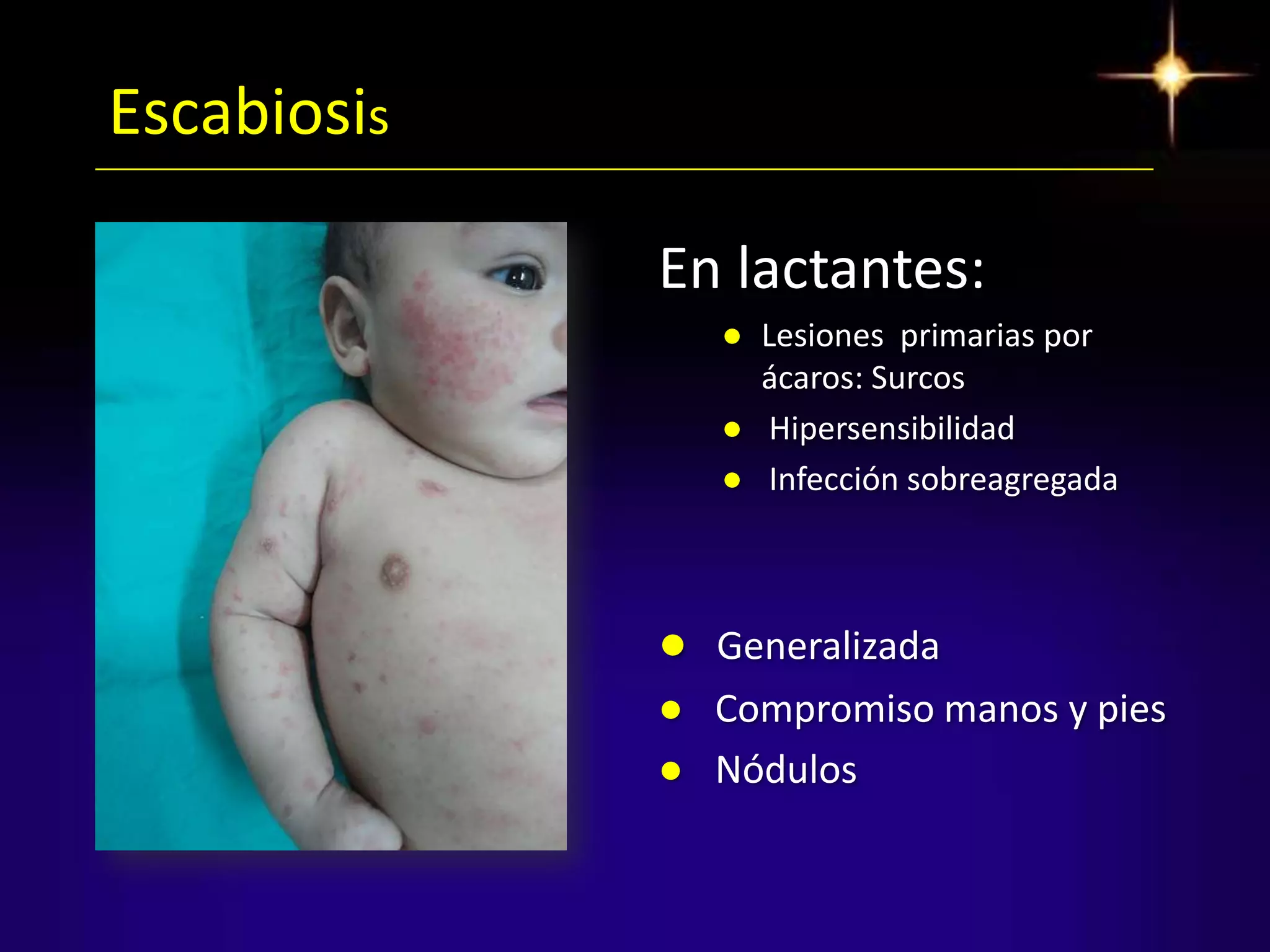 20 infecciones dermatológicas más frecuentes en pediatría escabiosis ...