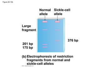 Figure 20.10b
Large
fragment
Normal
allele
Sickle-cell
allele
201 bp
175 bp
376 bp
(b) Electrophoresis of restriction
fragments from normal and
sickle-cell alleles
 