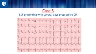 Where Does Cardiac POCUS Fit In? (Cardiac Imaging Symposium) | PDF