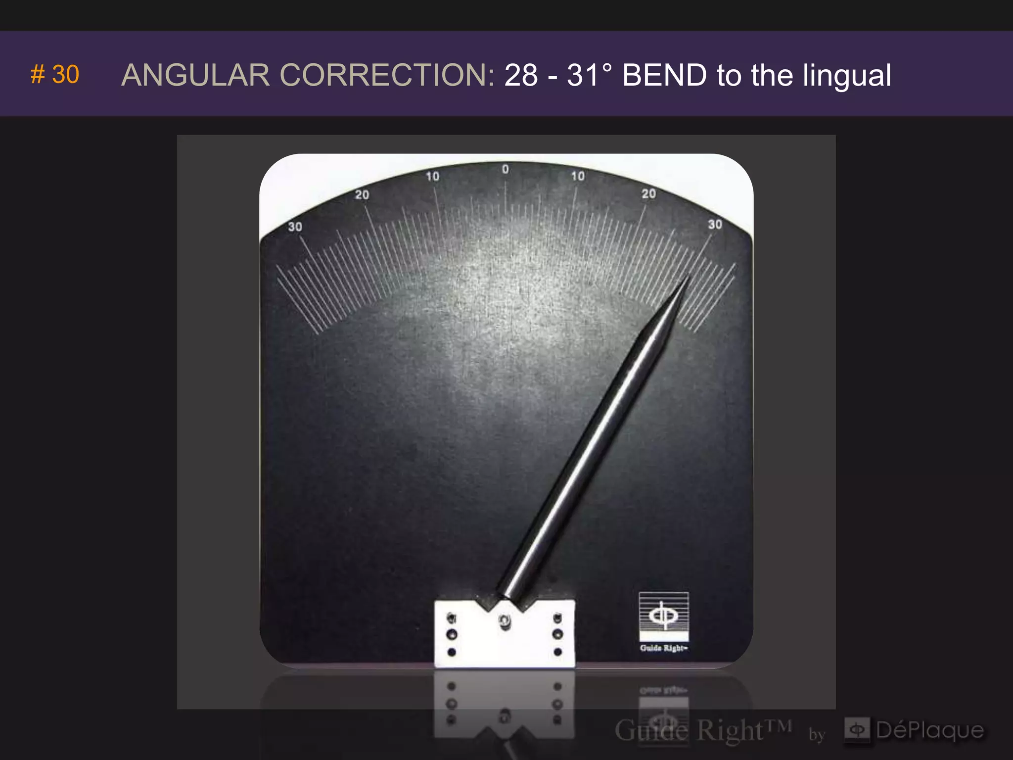 Invivo5
# 30   ANGULAR CORRECTION: 28 - 31° BEND to the lingual
                         Anatomage
 
