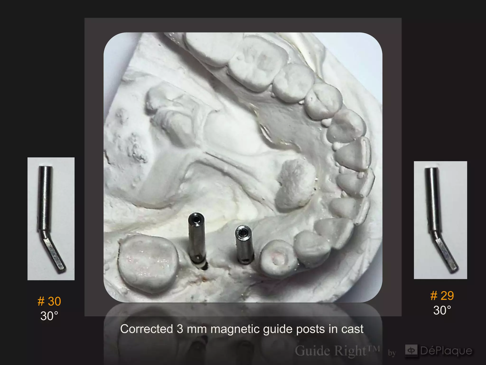 # 30                                                 # 29
30°                                                  30°
       Corrected 3 mm magnetic guide posts in cast
 