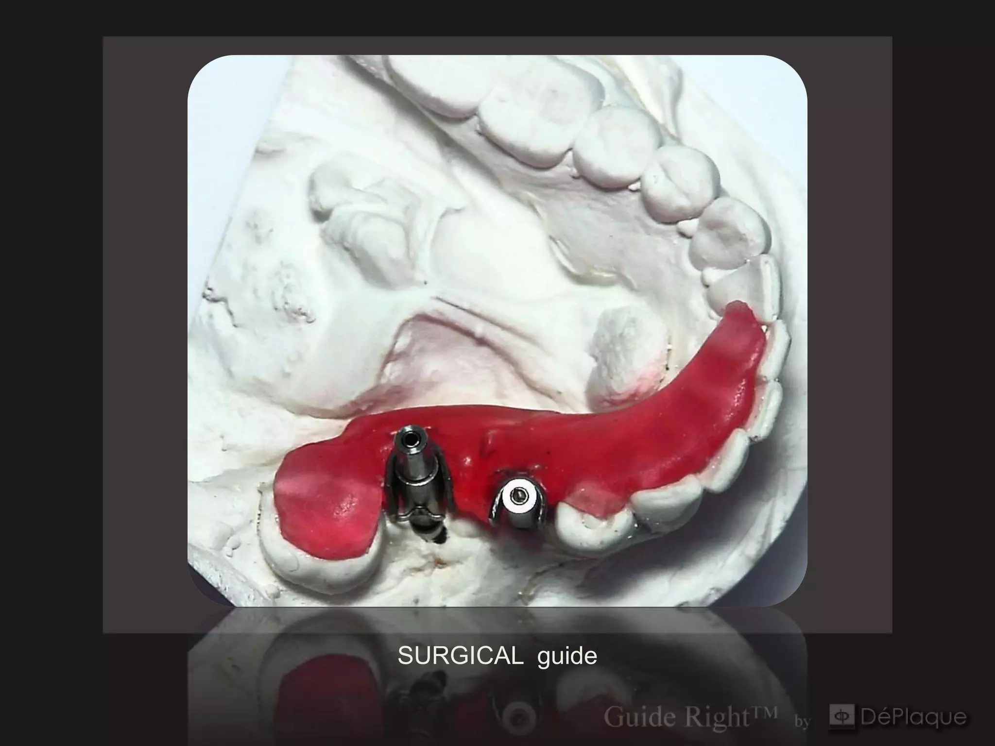 SURGICAL guide
 