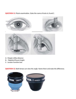 QUESTION 11: Ptosis examination. State the name of tests A, B and C.
A- Margin-reflex distance
B- Palpebral fissure height
C- Levator function test
QUESTION 12: Both lenses can view the angle. Name them and state the difference.
 