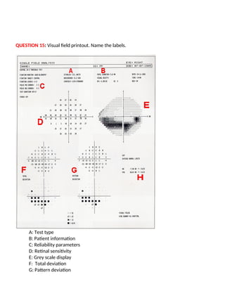 QUESTION 15: Visual field printout. Name the labels.
A: Test type
B: Patient information
C: Reliability parameters
D: Retinal sensitivity
E: Grey scale display
F: Total deviation
G: Pattern deviation
 