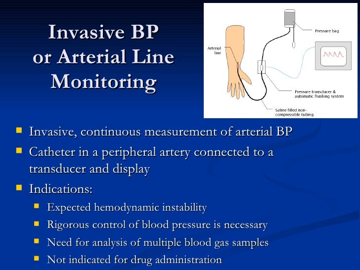 20 patient monitoring
