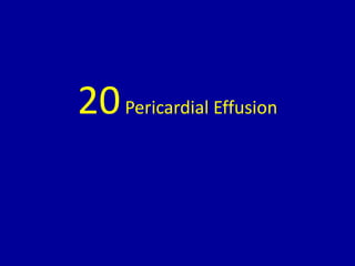 20Pericardial Effusion
 