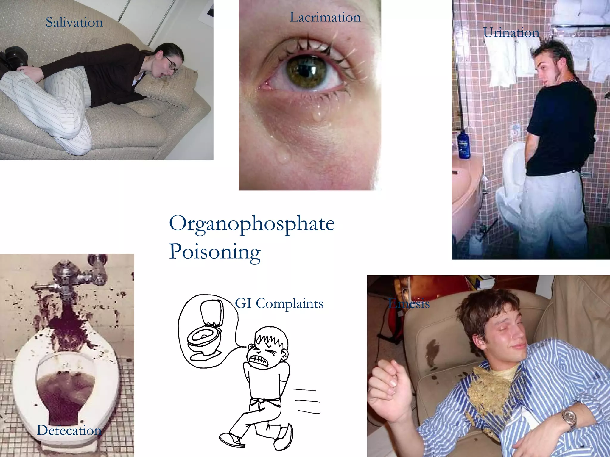 Salivation Lacrimation  Urination Defecation  GI Complaints Emesis   Organophosphate Poisoning   