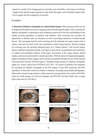 18
based on a model of the imaging process provides more flexibility, with respect to both the
imaged scene and the image acquisition setup itself. But again, such simulated images often
fail to capture the full complexity of real data.
Examples-
1. Detection of diabetic retinopathy in retinal fundus images- Many diseases of the eye can
be diagnosed through non-invasive imaging of the retina through the pupil. Early screening for
diabetic retinopathy is important as early treatment can prevent vision loss and blindness in the
rapidly growing population of patients with diabetes. Such screening also provides the
opportunity to identify other eye diseases, as well as providing indicators of cardiovascular
disease. The increasing need for such screening, and the demands for expert analysis that it
creates, motivates the goal of low cost, quantitative retinal image analysis. Routine imaging
for screening uses the specially designed optics of a ‘fundus camera,’ with several images
taken at different orientations (fields, see Figure 2) and can be accomplished with (mydriatic)
or without (non-mydriatic) dilation of the pupil. Assessment of the image requires skilled
readers, and may be performed by remote specialists. With the advent of digital photography,
digital recording of retinal images can be carried out routinely through Picture Archiving and
Communication Systems (PACS).Figure 2: Standard image formats for diabetic retinopathy
(right eye). Source: taken from EYEPACS LLC 2017. As a point of reference, the standards
for screening for diabetic retinopathy in the UK require at least 80% sensitivity and 95%
specificity to determine referral for further evaluation. Screening using fundus photography,
followed by manual image analysis, yields sensitivity and specificity rates cited as 96%/89%
when two fields (angles of view) are included, and 92%/97% for three fields. (For a single
field, cited rates are 78%/86%).
 
