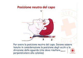 Dinamiche lesive del collo
 