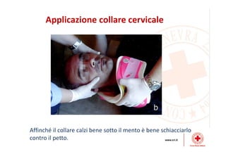 Applicazione collare cervicale
Affinché il collare calzi bene sotto il mento è bene schiacciarlo
contro il petto.
 