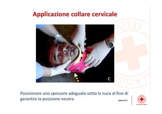 Applicazione collare cervicale
Posizionare uno spessore adeguato sotto la nuca al fine di
garantire la posizione neutra.
 