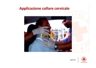 Applicazione collare cervicale
 