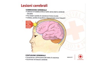 Lesioni cerebrali
 