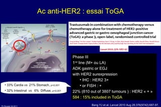 Ac anti-HER2 : essai ToGA Bang YJ et al. Lancet 2010 Aug 28;376(9742):687-97.  Phase III 1 rst  line (M+ ou LA) ADK gastric or EGJ  with HER2 surexpression IHC : HER2 3+  or FISH : +  22% (810 out of 3807 tumours ) : HER2 « + » 584 : 15% included in ToGA 33% Cardia  vs   21% Stomach,  p<0,001 32% Intestinal  vs   6%  Diffuse,  p<0,001 