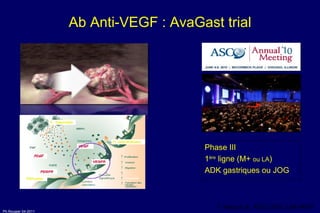Ab Anti-VEGF : AvaGast trial Y. Kang et al., ASCO 2010, LBA #4007 Phase III 1 ère  ligne (M+  ou LA ) ADK gastriques ou JOG 