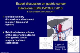 Multidisciplinary discussion and treatment in expert teams and centers Relation between volume of the center and outcome after gastric cancer surgery has been established Expert discussion on gastric cancer Barcelona ESMO/WCGIC 2010  E Van Cutsem Ann Oncol 2011 2 types of  Resections Distal - Total 