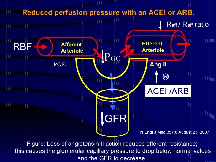 20 Saxena Acute Renal Failure