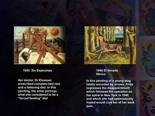 1945 Sin Esperanza
Her doctor, Dr Eloesser,
prescribed complete bed rest
and a fattening diet. In this
painting, the artist portrays
what she considered to be a
"forced feeding" diet
In this painting of a young stag
fatally wounded by arrows, Frida
expresses the disappointment
which followed the operation on
her spine in New York in 1946,
and which she had optimistically
hoped would cure her of her back
pain.
1946 El Venado
Herico
 