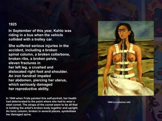 1925
In September of this year, Kahlo was
riding in a bus when the vehicle
collided with a trolley car.
She suffered serious injuries in the
accident, including a broken
spinal column, a broken collarbone,
broken ribs, a broken pelvis,
eleven fractures in
her left leg, a crushed and
dislocated right foot and shoulder.
An iron handrail impaled
her abdomen, piercing her uterus,
which seriously damaged
her reproductive ability.
1944 La columna rota
In 1944 when Frida painted this self-portrait, her health
had deteriorated to the point where she had to wear a
steel corset. The straps of the corset seem to be all that
is holding the artist's broken body together and upright.
An Ionic column, broken in several places, symbolizes
her damaged spine.
 