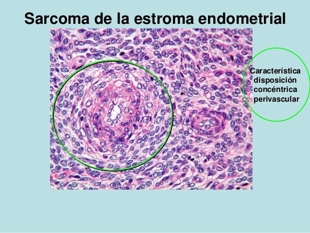 Resultado de imagen para estroma endometrial